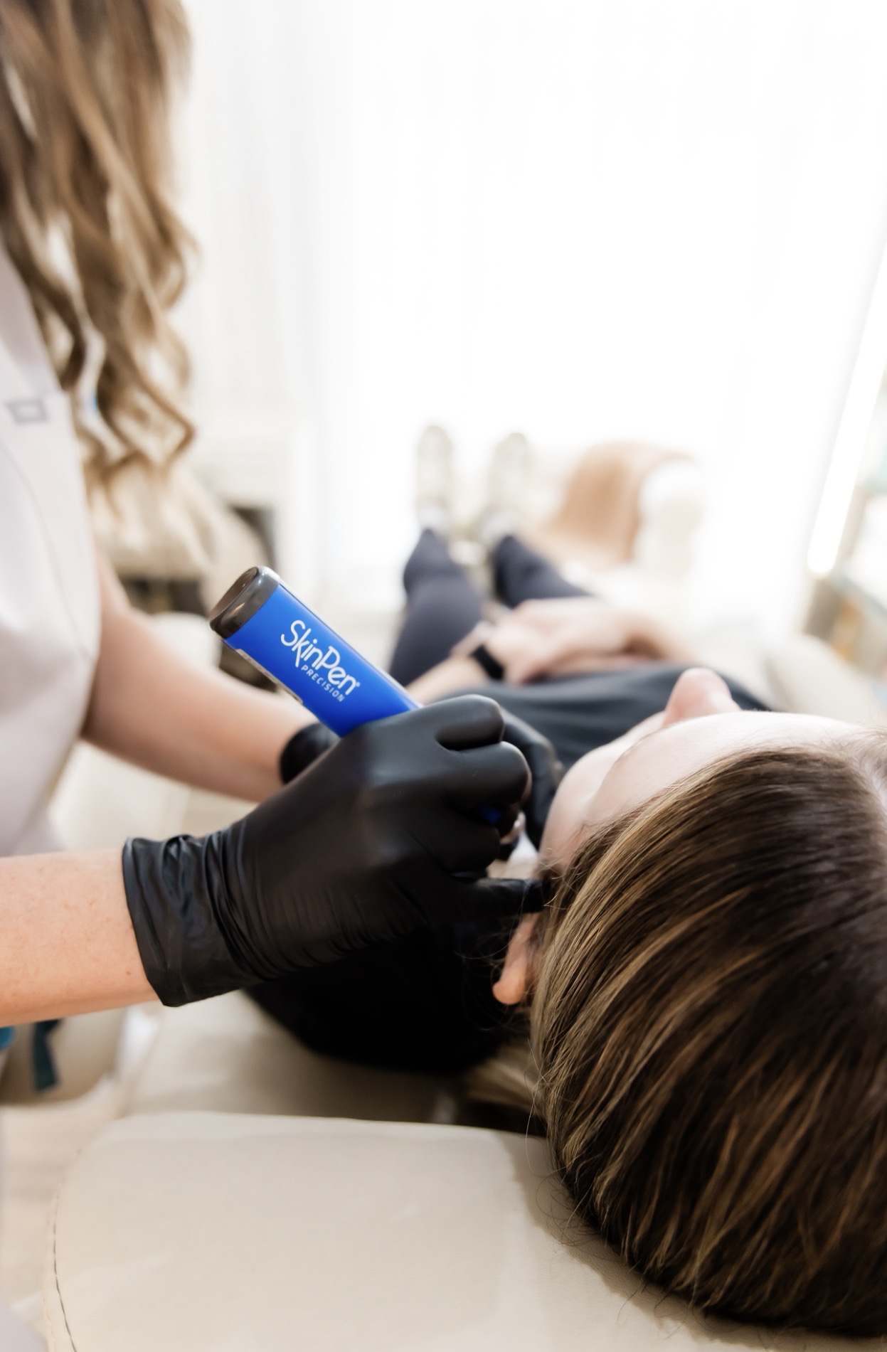 Skin Needling at Vue Aesthetics + Skin, North Lakes